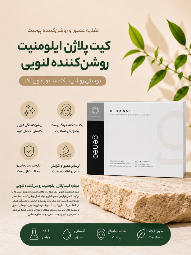 کیت پلاژن ایلومنیت